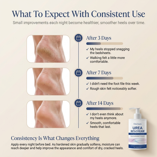 SoftStep – Overnight Heel Recovery Cream